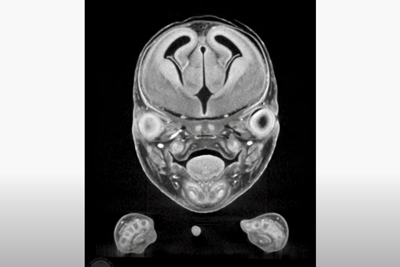 マウス胎児CT/2D(冠状断像)