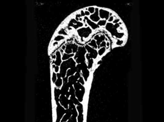 骨のX線CT撮影画像1